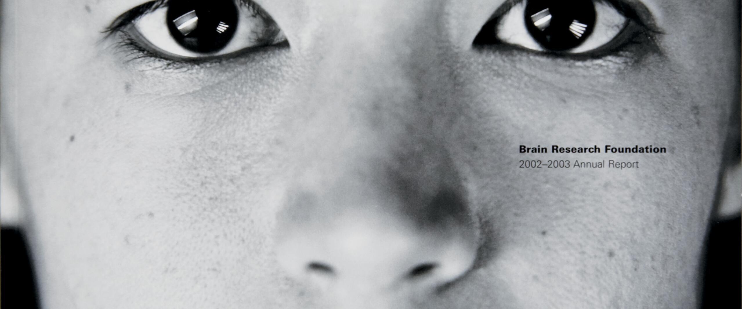 Close-up of a person's face in black and white with various neurological and psychological conditions written on the forehead, including epilepsy, autism, and Alzheimer's disease. The image features a serious expression.